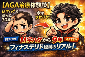 【AGA治療体験談】M字ハゲから9年。フィナステリド継続のリアル